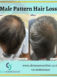 Hair Restoration & Scalp Treatments
