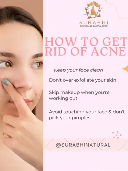 Here are a few simple tips to help manage acne. Keeping your face clean, avoiding over-exfoliation, and not picking your pimples can make a huge difference in your skin's health.