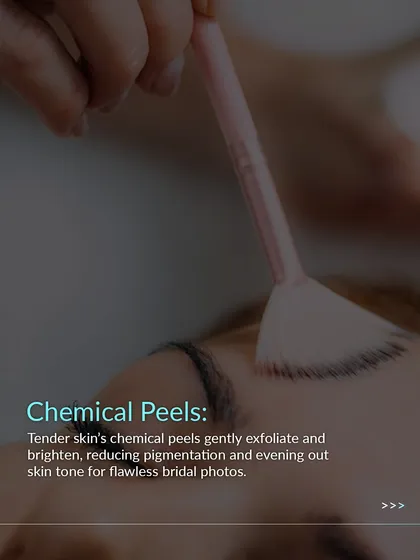 Chemical peels are a key part of our bridal packages. They gently exfoliate and brighten the skin, reducing pigmentation and evening out skin tone for flawless wedding photos.
