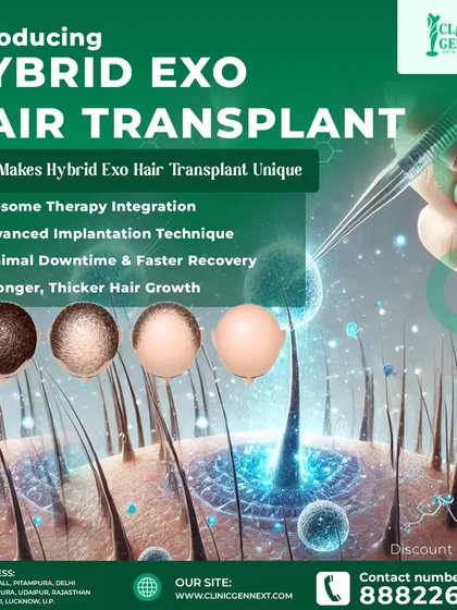 I am proud to offer the Hybrid Exo Hair Transplant. This unique technique integrates Exosome Therapy for stronger, thicker hair growth with minimal downtime and faster recovery.
