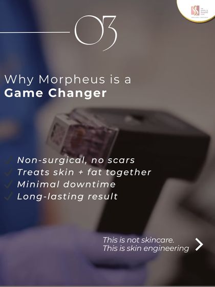 This graphic explains why Morpheus8 is a game-changer in skin engineering. It is a non-surgical treatment that addresses both skin and fat together with minimal downtime, leading to long-lasting skin tightening and rejuvenation.