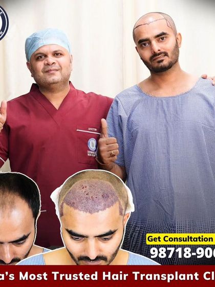 A happy doctor and a happy patient. This collage shows the journey of implanting 3858 grafts, from the pre-surgery thinning to the immediate post-operative result, on the way to a fuller look.