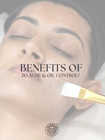 The ZO Acne & Oil Control facial is a targeted treatment to manage breakouts. This image shows the application of a purifying mask to help regulate sebum and clear pores.