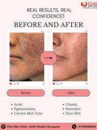 Advanced Facials & Peels