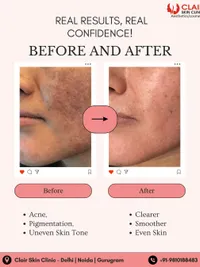 Advanced Facials & Peels