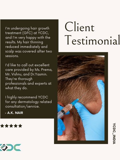 A client testimonial praising the immediate reduction in hair thinning after GFC treatment. He highlights the excellent care and professionalism of my team.