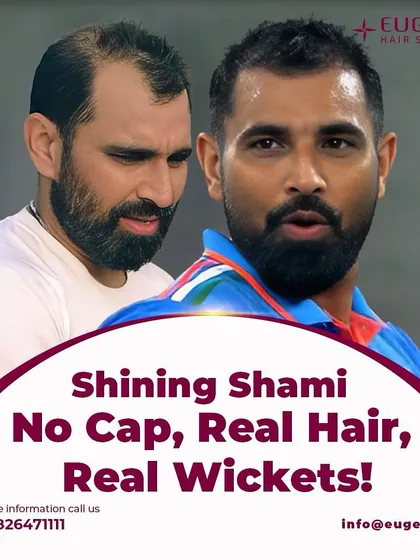 No cap needed. Mohammed Shami's real hair and real wickets are a testament to his skill and renewed confidence. We are happy to have been part of his journey.