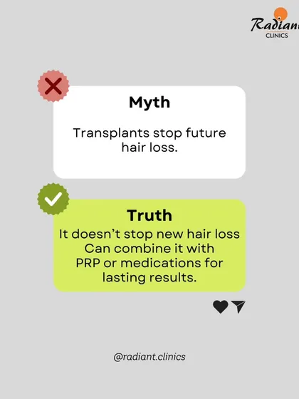 It's important to separate myth from truth. A common misconception is that a hair transplant is a one-time fix for all future hair loss. The truth is, a transplant doesn't stop your existing, non-transplanted hair from thinning. That is why I often combine surgical procedures with non-surgical treatments like PRP to maintain existing hair and ensure long-lasting, natural results.