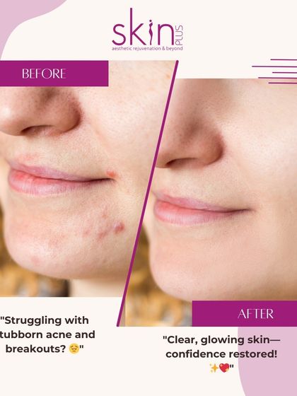 Real Results: Before & After photo 6