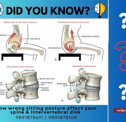 This scientific illustration explains exactly how wrong sitting posture affects your spine and intervertebral discs. Understanding the mechanics of disc pressure and misalignment helps motivate the need for better posture.
