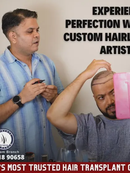 Designing the perfect hairline is both a science and an art. Here, you can see me personally working with a patient, marking out a custom hairline that will suit his facial structure and look completely natural. Your involvement in this step is crucial.