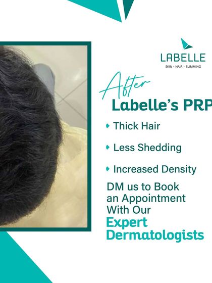 LaBelle - Hair Loss Treatment & Restoration Real Results: Before & After Gallery photo 4