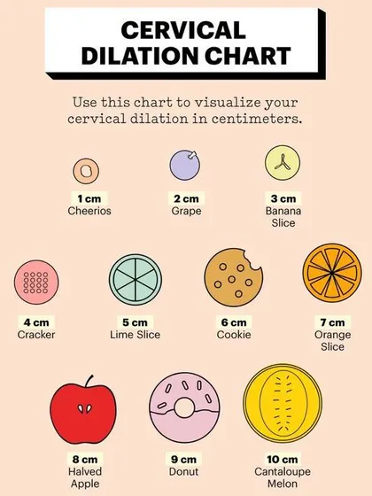 This cervical dilation chart uses familiar objects like fruits and cookies to help you visualize the stages of labor. It's a helpful and easy-to-understand guide for what to expect during childbirth.