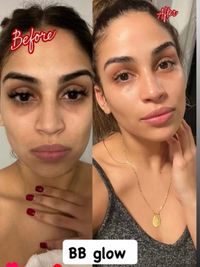 Advanced Skin Treatments