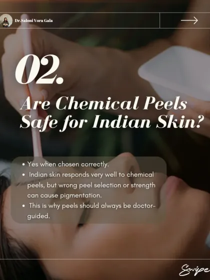 A common question I get is whether chemical peels are safe for Indian skin. The answer is yes, but only when the correct peel and strength are chosen by a doctor. The wrong choice can cause pigmentation, which is why professional guidance is essential.