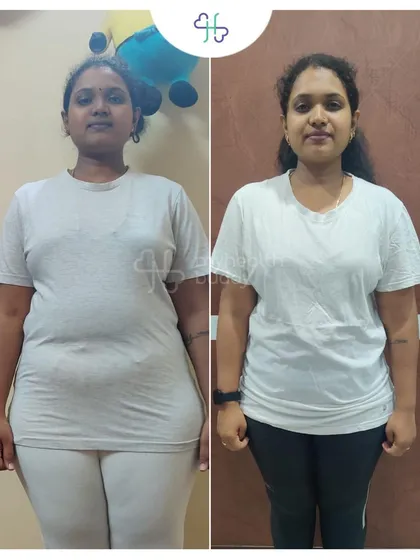 Ramya's before and after photos show a clear change in her physique. Her story is an inspiration for new moms looking to start their fitness journey.