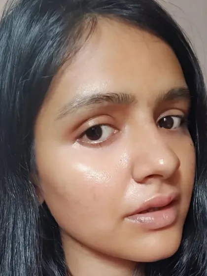 A close up of the client's skin before we begin, showing her natural complexion.