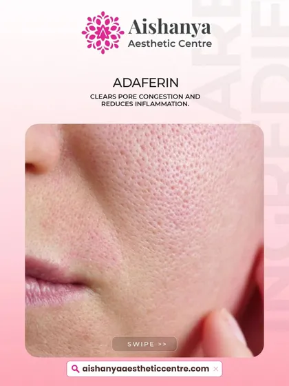 Adaferin, a type of retinoid, is fantastic for clearing pore congestion. It speeds up cell turnover and reduces inflammation, making it a key tool in the fight against acne and large pores.