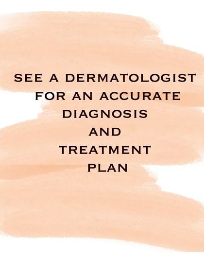 Rosacea is a common skin condition that is often overlooked or misdiagnosed. An accurate diagnosis from a dermatologist is the first step to creating a treatment plan that manages triggers and reduces flare-ups.