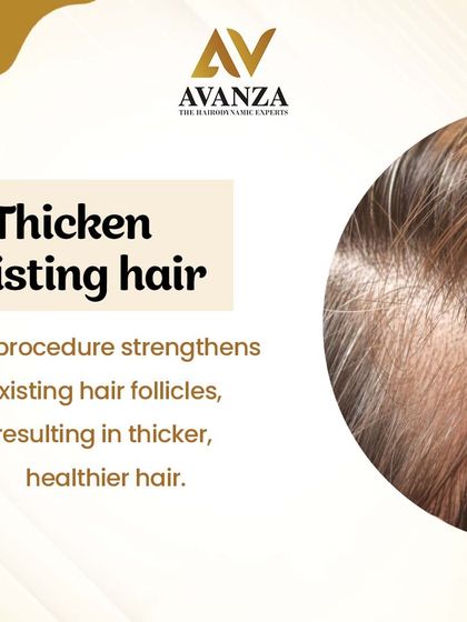 PRP strengthens existing hair follicles, which results in thicker, healthier hair. This procedure helps improve the overall density and texture of your hair without any surgical intervention.