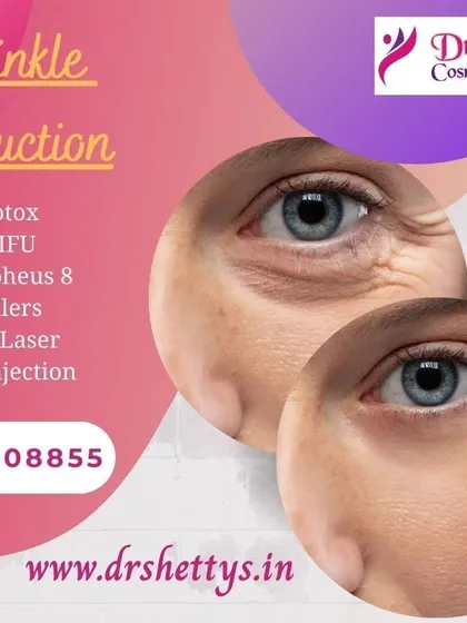 If you are concerned about fine lines and wrinkles, I offer several effective anti-aging treatments. This graphic shows the visible reduction in crow's feet, achieved through procedures like Botox, fillers, or advanced CO2 laser resurfacing for smoother, younger-looking skin.