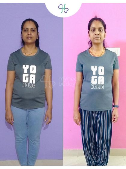 This client learned about Diastasis Recti after her pregnancy and decided to take action. In 12 weeks, she lost 6 kgs and significantly improved her core strength by focusing on portion control and targeted exercises.