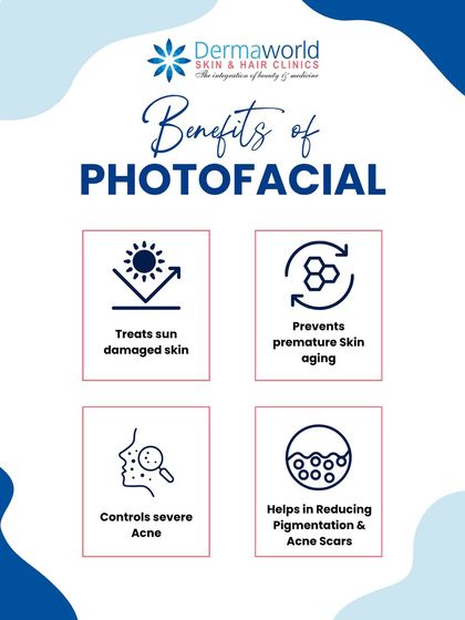 A Photofacial is a light-based therapy that effectively treats sun-damaged skin and controls severe acne. It also helps reduce pigmentation and acne scars, preventing premature skin aging and promoting a clearer complexion.