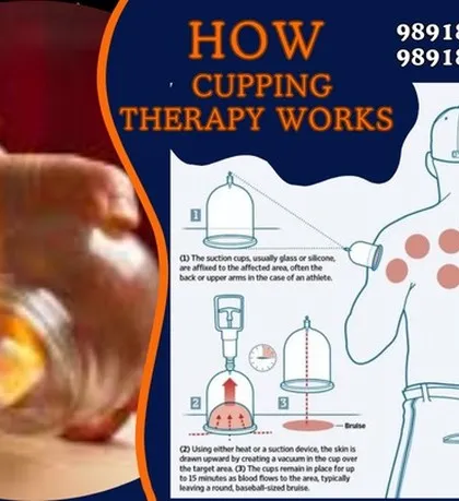 This graphic explains how cupping therapy works. The suction draws skin upwards, creating space to improve blood flow and break up stagnant lactic acid in the muscle fibers. This is why it's so effective for decreasing muscle pain and tightness.