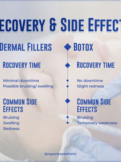 Recovery is minimal for both. With fillers, you might experience some bruising or swelling. With Botox, there is virtually no downtime, though slight redness or temporary weakness at the injection site can occur.