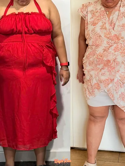 This is Anjali, who was diagnosed with Type 2 Diabetes. She committed to change and is already 8.6kg down. We built a routine around swimming and walks, and she's taking control of her health while still enjoying life.