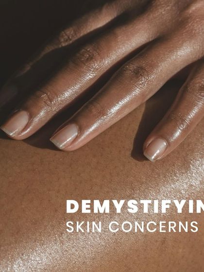 Let's demystify common skin concerns. Understanding issues like acne, hyperpigmentation, or eczema is the first step towards treating them effectively and achieving clear, healthy skin.