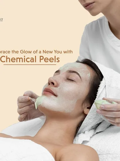 A chemical peel is a fantastic way to reset your skin. Here, a client is receiving a professionally applied peel, a procedure we use to gently exfoliate, reduce hyperpigmentation, and reveal a smoother, more radiant complexion underneath. It is a controlled and safe way to achieve a healthy glow.