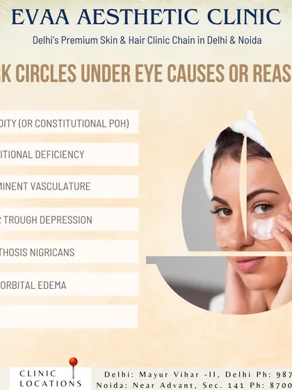 This infographic lists the common causes and reasons for under-eye dark circles. Factors can range from heredity and nutritional deficiencies to aging and tear trough depression.