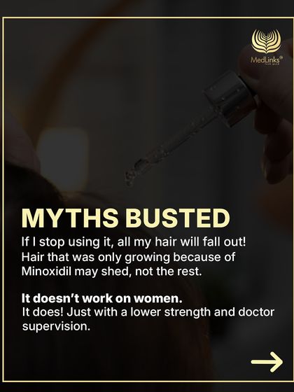 Let's bust some myths. Stopping Minoxidil won't make all your hair fall out, only the hair that was growing because of it. And yes, it does work for women under a doctor's supervision.