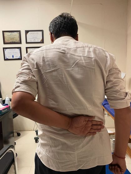 Another angle showing the initial restricted movement Mr. Deepak experienced. We use these baseline measurements to track progress throughout therapy.