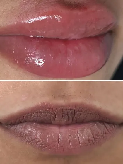 This is a clear example of neutralizing dark, cool-toned lips. The 'before' shows significant pigmentation, and the 'after' reveals a complete color shift to a warm, rosy pink. The lips appear healthier, plumper, and more vibrant.