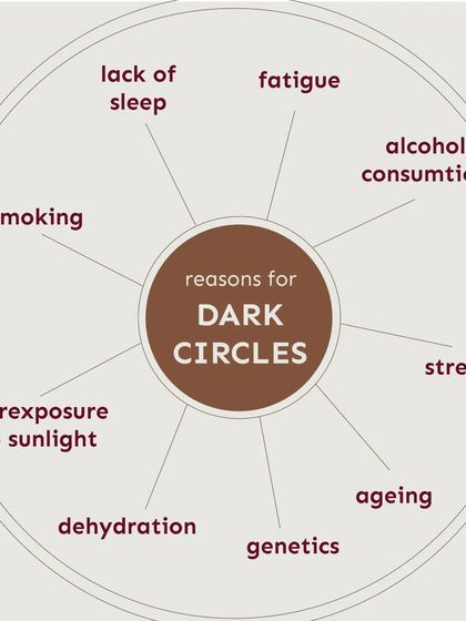 This diagram outlines the various reasons for dark circles, including lifestyle factors like fatigue and smoking, as well as internal factors like dehydration and genetics. Identifying the cause is the first step to effective treatment.