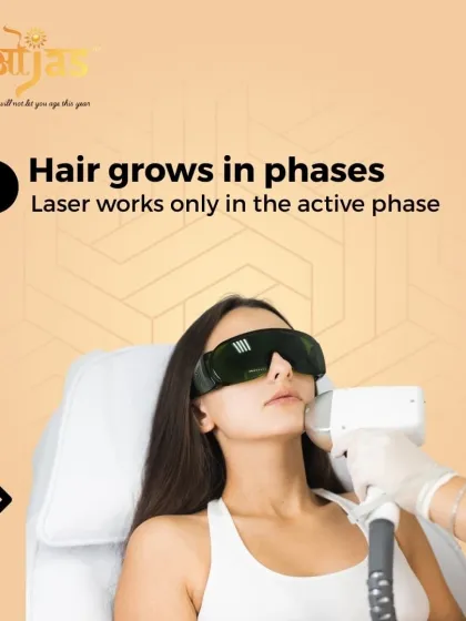 The laser is only effective on hair in its active growth phase. Since not all hairs are in this phase at the same time, multiple sessions are required to treat all follicles as they cycle through.