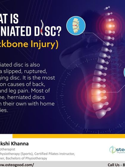 A herniated disc, also known as a slipped or bulging disc, is a common backbone injury causing back, neck, and leg pain. This infographic explains what it is and how it occurs.