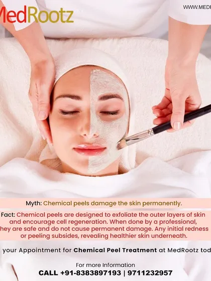 A common myth is that chemical peels permanently damage the skin. The fact is, when done by a professional, they safely exfoliate the outer layers to encourage cell regeneration, revealing healthier skin underneath.