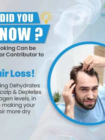 Did you know smoking is a major contributor to hair loss? It dehydrates the scalp and depletes collagen, making hair dry and brittle.