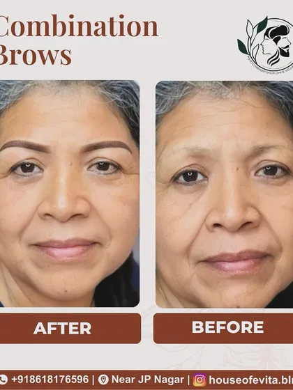 Permanent makeup is for everyone. For this client, I used Combination Brows to restore shape and definition that had been lost over time, creating a subtle lift and a more youthful appearance.
