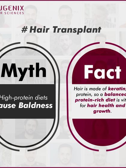 Myth: High-protein diets cause baldness. Fact: Hair is primarily made of a protein called keratin. A balanced, protein-rich diet is not a cause of baldness; in fact, it is vital for supporting strong hair health and encouraging growth.