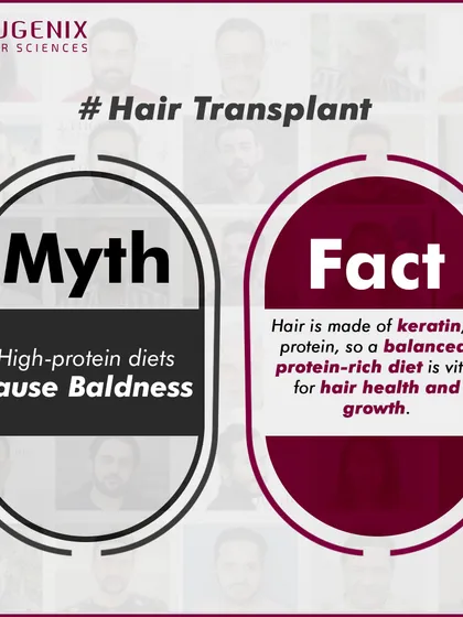 A series of graphics debunking common myths about fitness and hair loss, such as whether exercise, sweating, or high-protein diets cause baldness.