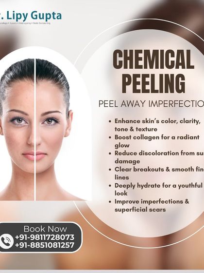 Chemical & Cosmelan Peels for Pigmentation photo 4