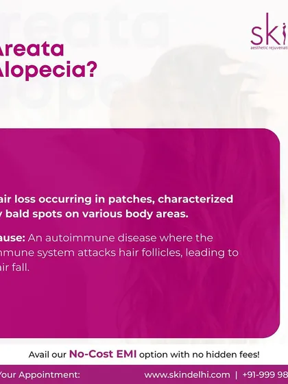 Understanding the cause of your hair loss is the first step. This graphic explains that Areata Alopecia is an autoimmune disease where the immune system attacks hair follicles, leading to patchy hair fall.