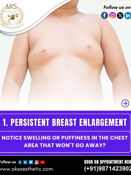 One of the first signs of gynecomastia is persistent swelling or puffiness in the chest area that doesn't go away with diet or exercise. This is because it involves glandular tissue, not just fat.
