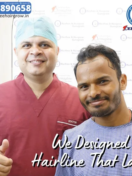 A happy client with Dr. Santpal Sangwan immediately after his hairline design was completed. We believe in a collaborative approach, ensuring you are confident and comfortable with the plan before the procedure begins.