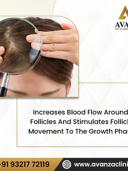 This visual explains one of the primary mechanisms of Minoxidil. It works by increasing blood flow around the follicles and stimulating them to move from a resting phase into an active growth phase.