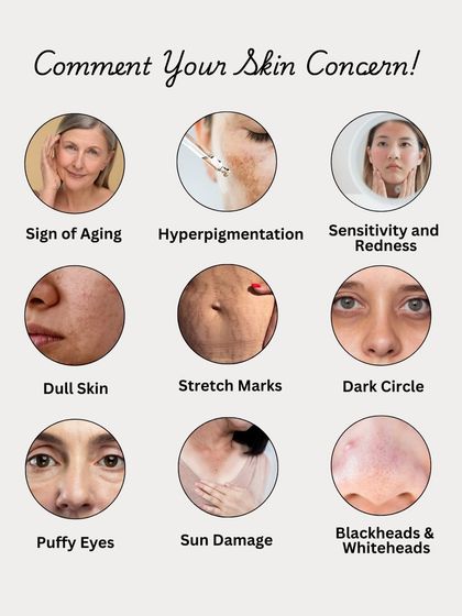 A visual guide to common skin concerns, from signs of aging and hyperpigmentation to dullness and dark circles. Comment with your concern, and we can help find a natural solution.